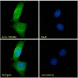 Immunofluorescence - Anti-TREM2 Antibody (A84373) - Antibodies.com