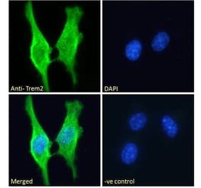 Immunofluorescence - Anti-TREM2 Antibody (A84374) - Antibodies.com