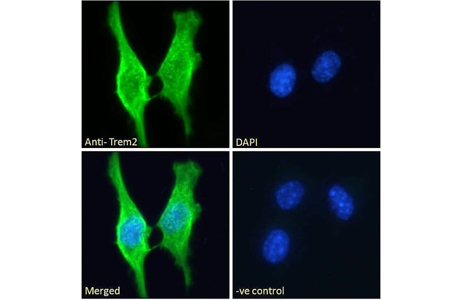 Immunofluorescence - Anti-TREM2 Antibody (A84374) - Antibodies.com