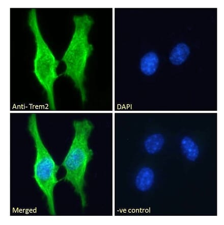 Immunofluorescence - Anti-TREM2 Antibody (A84374) - Antibodies.com