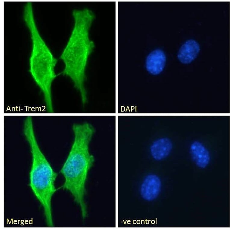 Immunofluorescence - Anti-TREM2 Antibody (A84374) - Antibodies.com