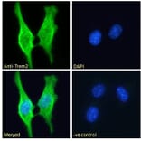 Immunofluorescence - Anti-TREM2 Antibody (A84374) - Antibodies.com