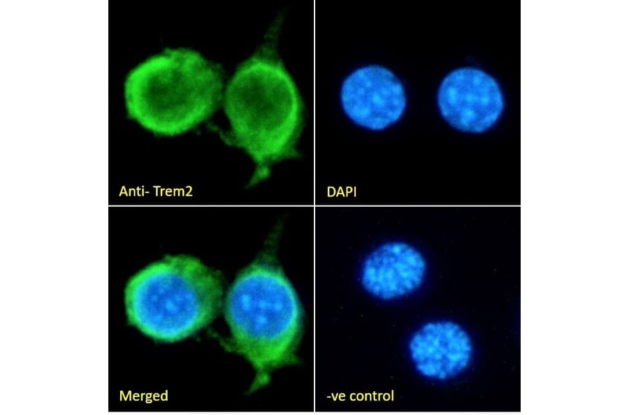 Immunofluorescence - Anti-TREM2 Antibody (A84374) - Antibodies.com