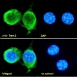 Immunofluorescence - Anti-TREM2 Antibody (A84374) - Antibodies.com