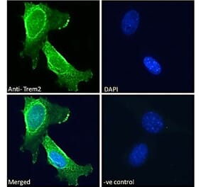 Immunofluorescence - Anti-TREM2 Antibody (A84374)