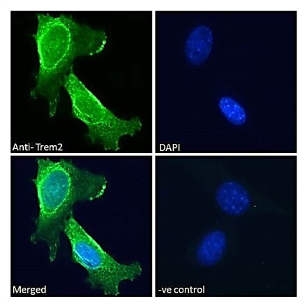 Immunofluorescence - Anti-TREM2 Antibody (A84374)