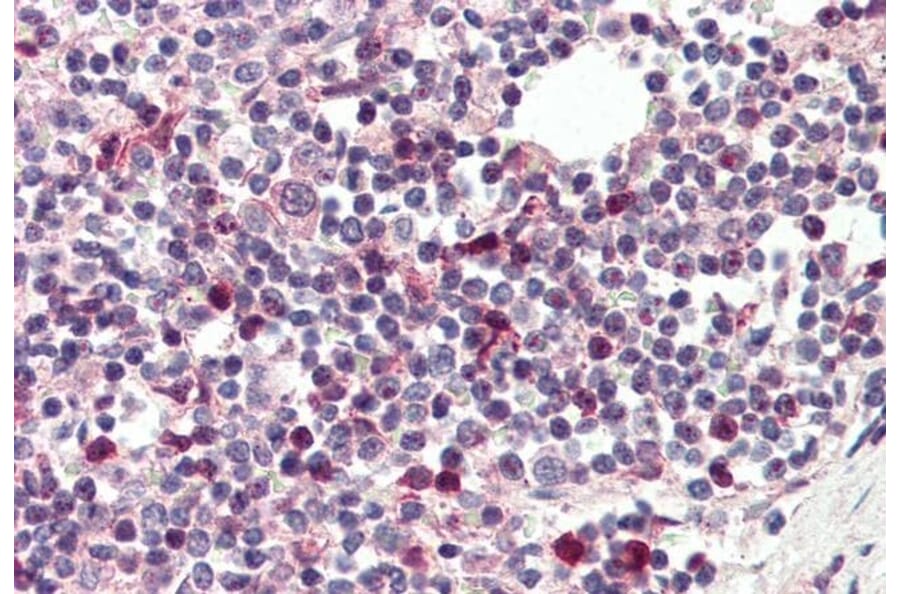 Immunohistochemistry - Anti-TFEC Antibody (A84375) - Antibodies.com