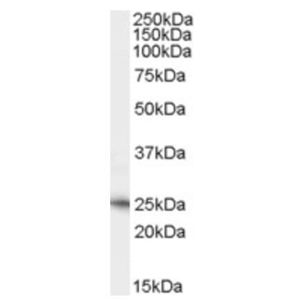 Western Blot - Anti-Neurturin Antibody (A84376) - Antibodies.com