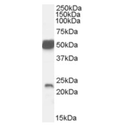 Western Blot - Anti-Neurturin Antibody (A84377) - Antibodies.com