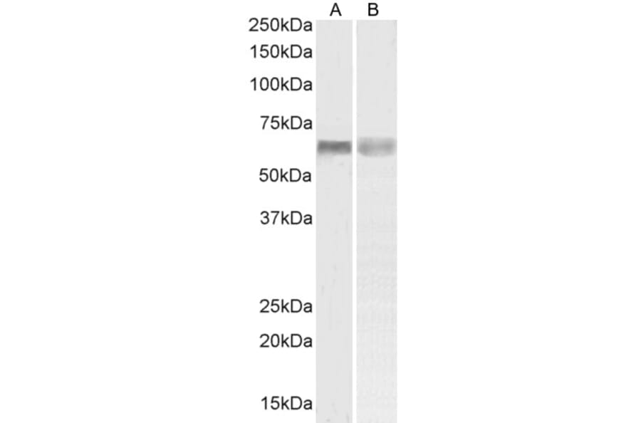 Western Blot - Anti-PINK1 Antibody (A84378) - Antibodies.com