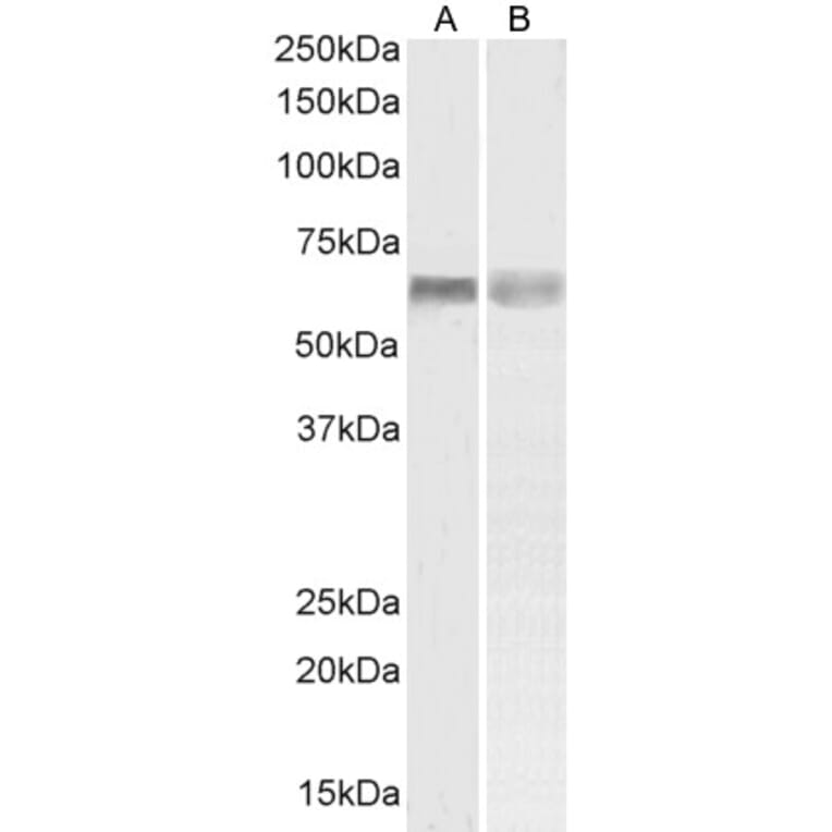 Western Blot - Anti-PINK1 Antibody (A84378) - Antibodies.com