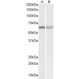 Western Blot - Anti-PINK1 Antibody (A84378) - Antibodies.com