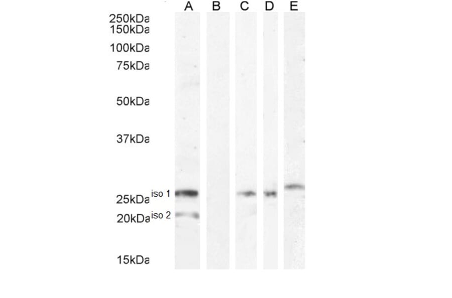 Western Blot - Anti-B7H4 Antibody (A84379) - Antibodies.com