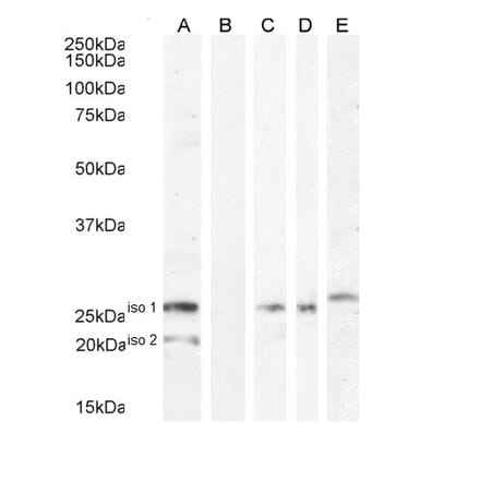 Western Blot - Anti-B7H4 Antibody (A84379) - Antibodies.com