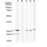 Western Blot - Anti-B7H4 Antibody (A84379) - Antibodies.com