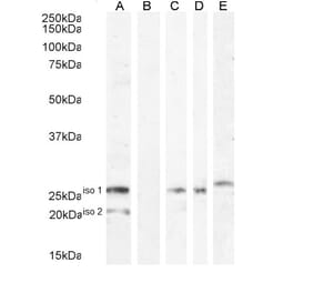 Western Blot - Anti-VTCN1 Antibody (A84379)