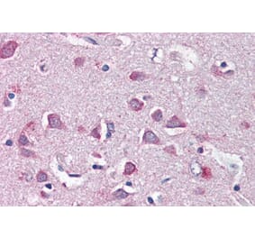 Immunohistochemistry - Anti-Neurofibromin 2 Antibody (A84381) - Antibodies.com