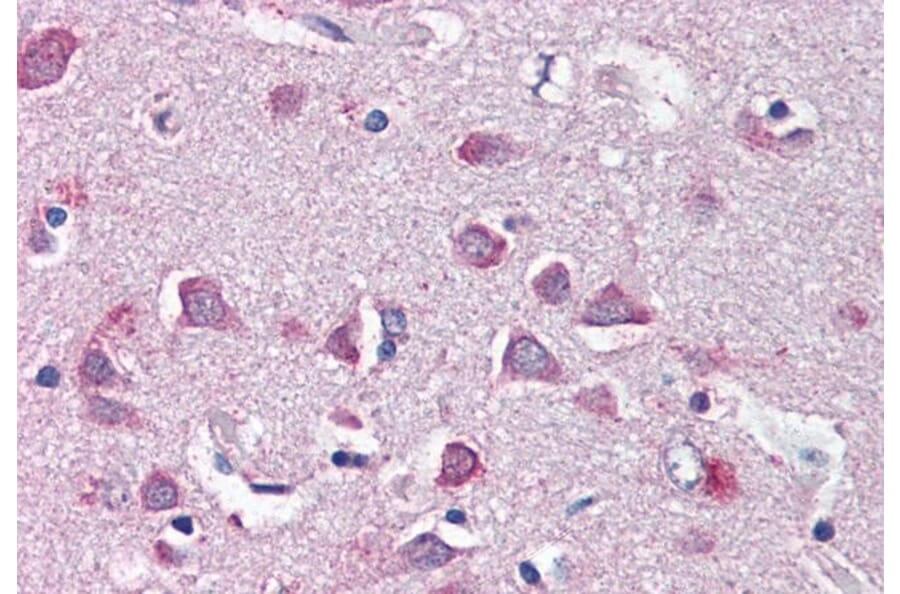 Immunohistochemistry - Anti-Neurofibromin 2 Antibody (A84381) - Antibodies.com