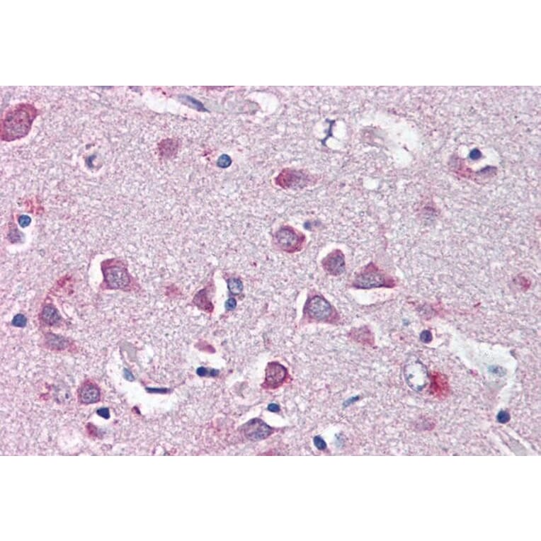 Immunohistochemistry - Anti-Neurofibromin 2 Antibody (A84381) - Antibodies.com