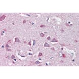 Immunohistochemistry - Anti-Neurofibromin 2 Antibody (A84381) - Antibodies.com