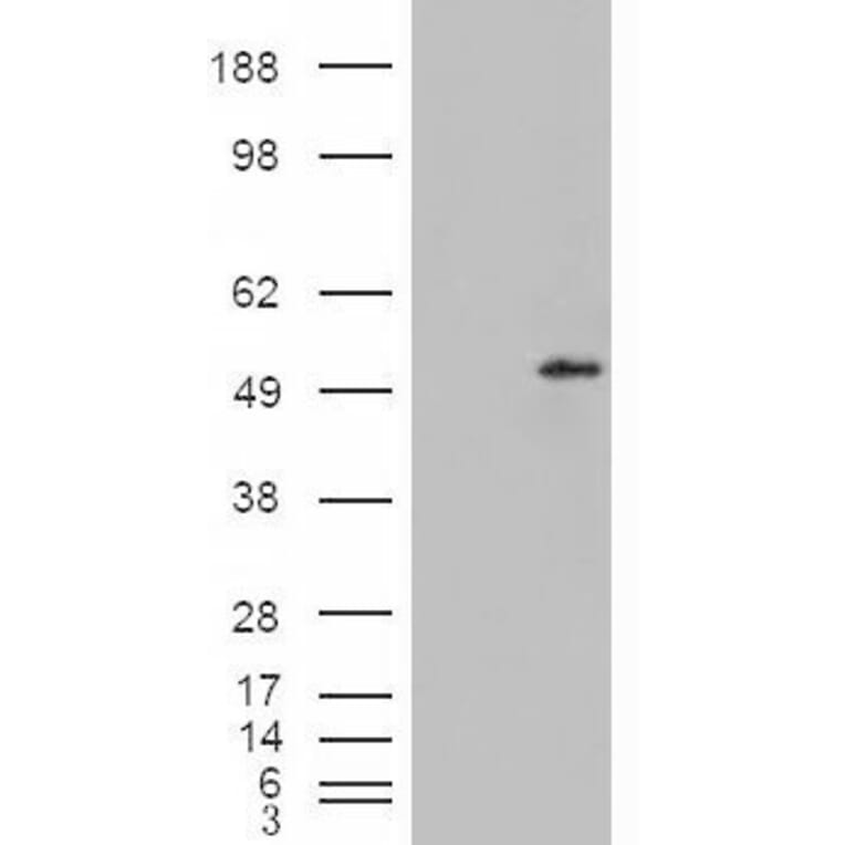 Western Blot - Anti-STEAP4 Antibody (A84383) - Antibodies.com