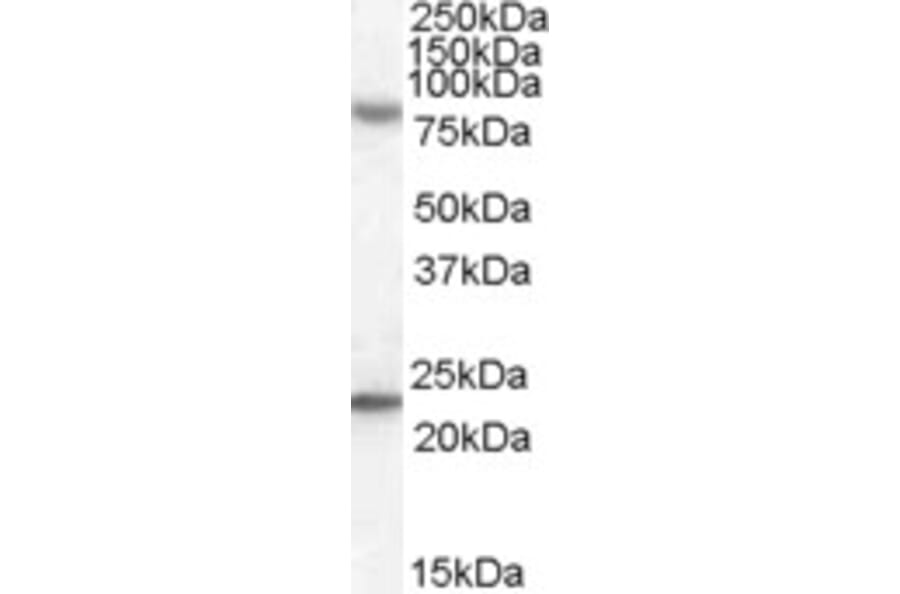 Western Blot - Anti-DHX58/RLR Antibody (A84384) - Antibodies.com
