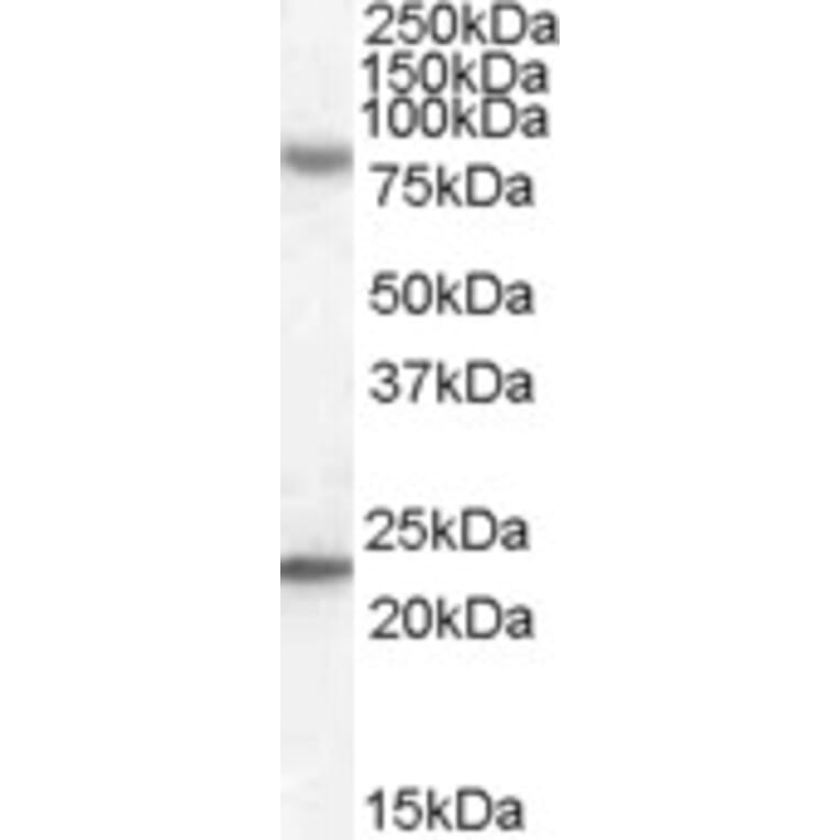 Western Blot - Anti-DHX58/RLR Antibody (A84384) - Antibodies.com