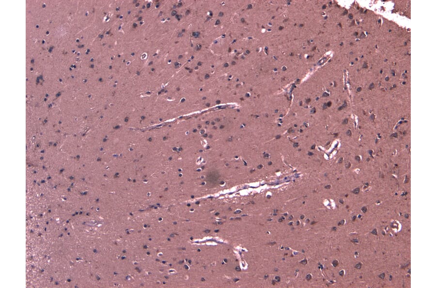 Immunohistochemistry - Anti-DHX58/RLR Antibody (A84384) - Antibodies.com
