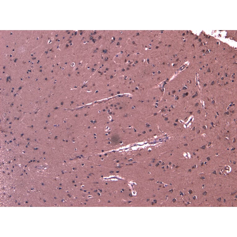 Immunohistochemistry - Anti-DHX58/RLR Antibody (A84384) - Antibodies.com