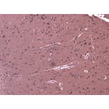 Immunohistochemistry - Anti-DHX58/RLR Antibody (A84384) - Antibodies.com