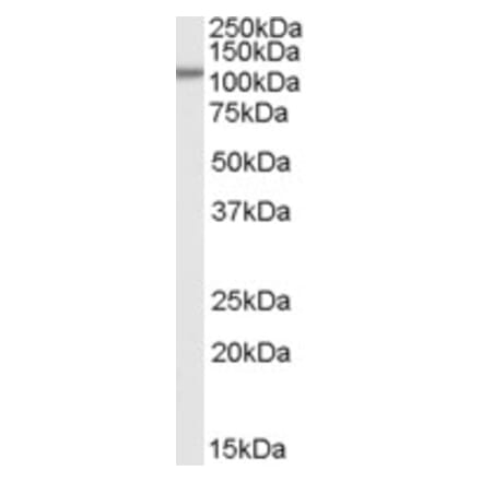Western Blot - Anti-Smek1 Antibody (A84385) - Antibodies.com