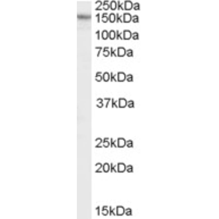 Western Blot - Anti-RPGRIP1L/FTM Antibody (A84386) - Antibodies.com