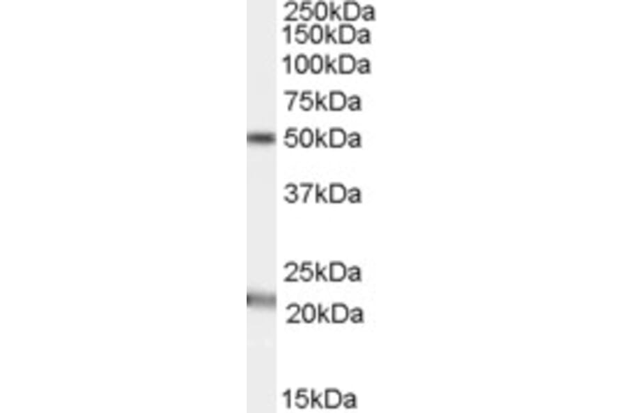Western Blot - Anti-AGK Antibody (A84387) - Antibodies.com