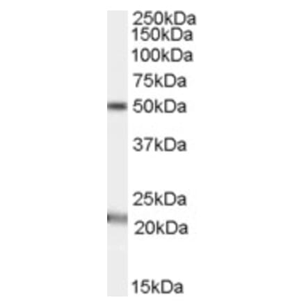 Western Blot - Anti-AGK Antibody (A84387) - Antibodies.com