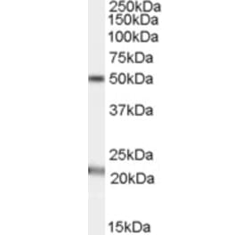Western Blot - Anti-AGK Antibody (A84387) - Antibodies.com