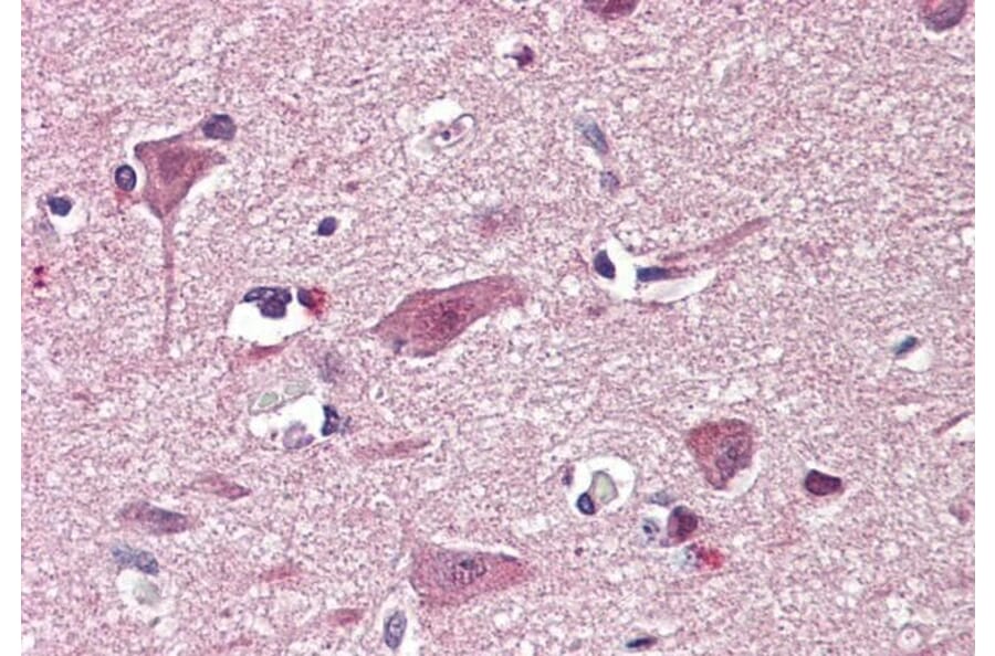 Immunohistochemistry - Anti-Chd7 Antibody (A84388) - Antibodies.com