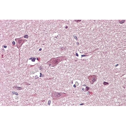 Immunohistochemistry - Anti-Chd7 Antibody (A84388) - Antibodies.com