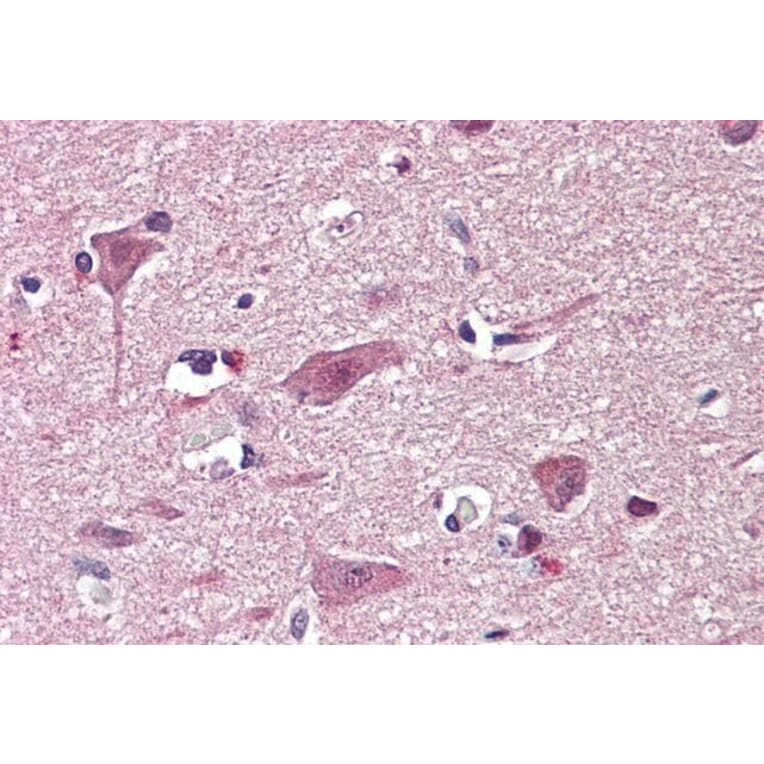 Immunohistochemistry - Anti-Chd7 Antibody (A84388) - Antibodies.com