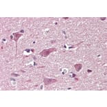 Immunohistochemistry - Anti-Chd7 Antibody (A84388) - Antibodies.com