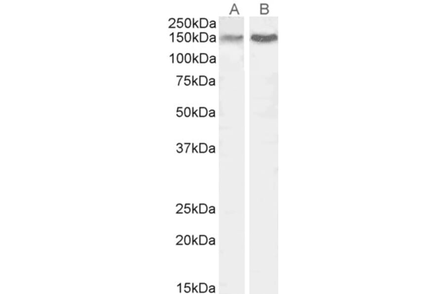 Western Blot - Anti-CTCF Antibody (A84389) - Antibodies.com