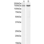 Western Blot - Anti-CTCF Antibody (A84389) - Antibodies.com