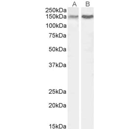 Western Blot - Anti-CTCF Antibody (A84389) - Antibodies.com