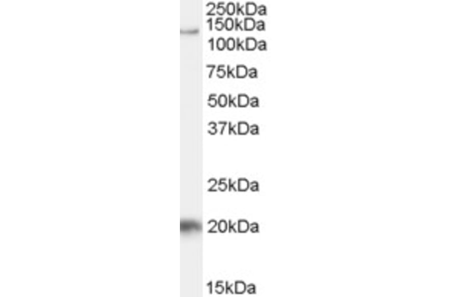 Western Blot - Anti-Tat-SF1 Antibody (A84391) - Antibodies.com