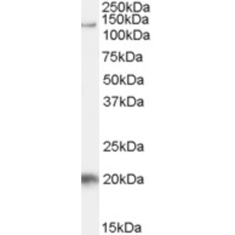 Western Blot - Anti-Tat-SF1 Antibody (A84391) - Antibodies.com