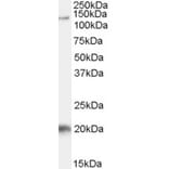 Western Blot - Anti-Tat-SF1 Antibody (A84391) - Antibodies.com