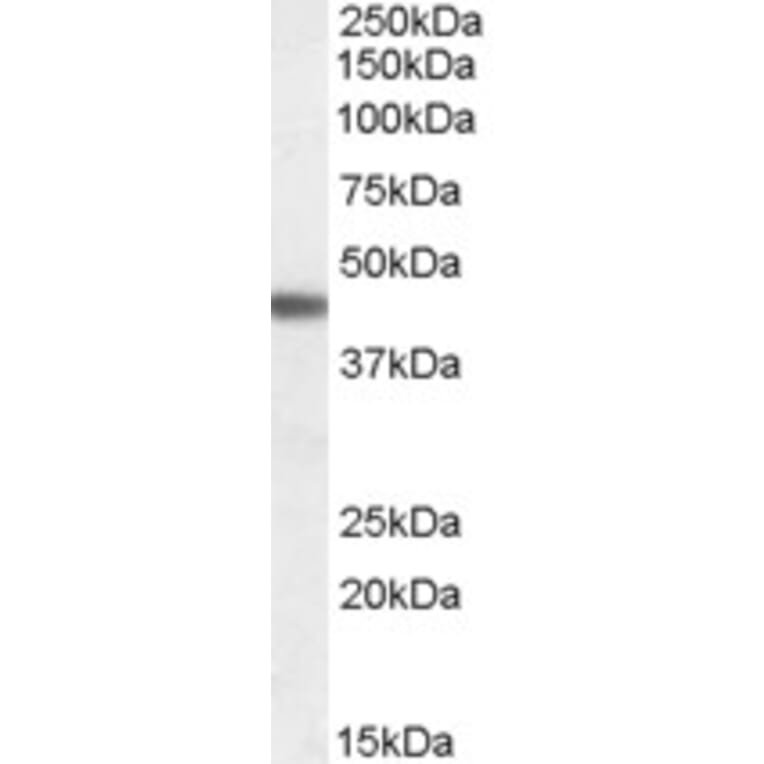 Western Blot - Anti-beta 3 Adrenergic Receptor Antibody (A84392) - Antibodies.com