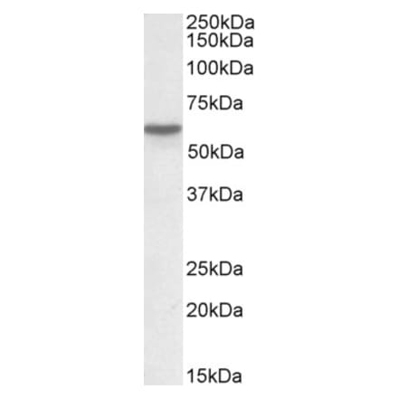 Western Blot - Anti-Vitamin D Binding Protein Antibody (A84393) - Antibodies.com