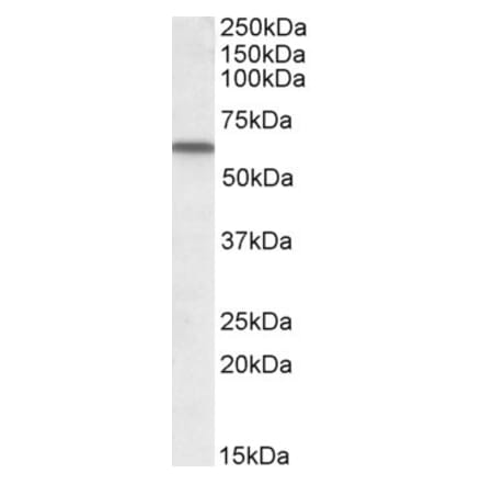 Western Blot - Anti-Vitamin D Binding Protein Antibody (A84394) - Antibodies.com