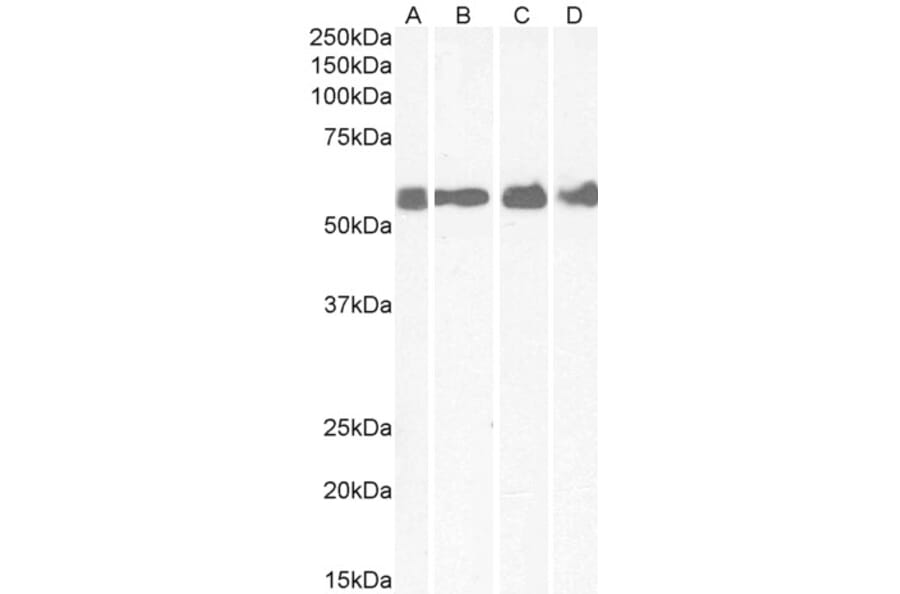 Western Blot - Anti-CRF1/CRHR1 Antibody (A84396) - Antibodies.com