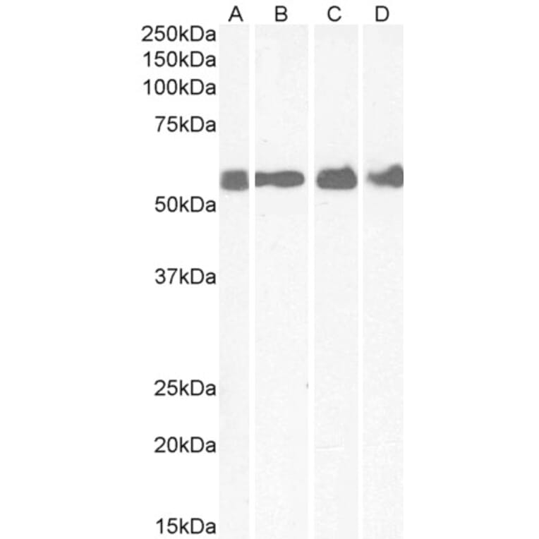 Western Blot - Anti-CRF1/CRHR1 Antibody (A84396) - Antibodies.com